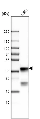 Western blot analysis in human cell line K562.