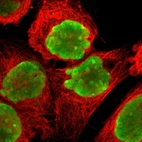 Immunofluorescent staining of human cell line A-431 shows localization to nucleus & nucleoli.