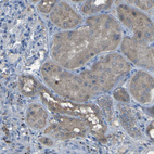 Immunohistochemical staining of human kidney shows moderate cytoplasmic positivity in cells in tubules.