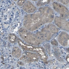 Immunohistochemical staining of human kidney shows moderate cytoplasmic positivity in cells in tubules.