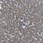 Immunohistochemical staining of human liver shows moderate cytoplasmic positivity in hepatocytes.