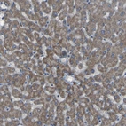 Immunohistochemical staining of human liver shows moderate cytoplasmic positivity in hepatocytes.