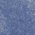 Immunohistochemical staining of human tonsil shows no cytoplasmic positivity in non-germinal center cells as expected.