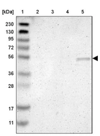 Lane 1: Marker [kDa] 230, 130, 95, 72, 56, 36, 28, 17, 11_br/_Lane 2: Human cell line RT-4_br/_Lane 3: Human cell line U-251MG sp_br/_Lane 4: Human plasma (IgG/HSA depleted)_br/_Lane 5: Human liver tissue