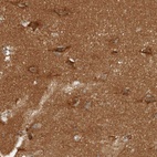 Immunohistochemical staining of human cerebral cortex shows high expression.