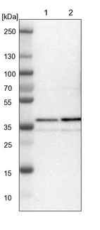 Lane 1: NIH-3T3 cell lysate (Mouse embryonic fibroblast cells)_br/_Lane 2: NBT-II cell lysate (Rat Wistar bladder tumour cells)