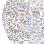 Anti-MS4A6A Antibody