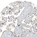 Immunohistochemical staining of human placenta shows moderate membranous and cytoplasmic positivity in trophoblastic cells.