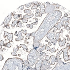 Immunohistochemical staining of human placenta shows moderate membranous and cytoplasmic positivity in trophoblastic cells.