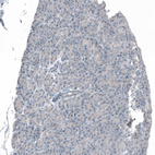 Immunohistochemical staining of human pancreas shows negative membranous positivity in exocrine glandular cells.