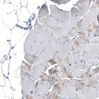 Immunohistochemical staining of human skeletal muscle shows negative membranous positivity in myocytes.