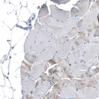 Immunohistochemical staining of human skeletal muscle shows negative membranous positivity in myocytes.