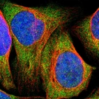 Immunofluorescent staining of human cell line U-2 OS shows localization to cytosol.