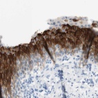 Anti-UPK3BL Antibody