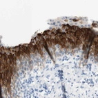 Anti-UPK3BL Antibody
