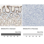 Anti-B4GALNT3 Antibody