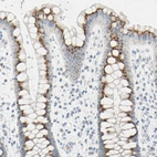 Immunohistochemical staining of human rectum shows strong granular cytoplasmic positivity in glandular cells.