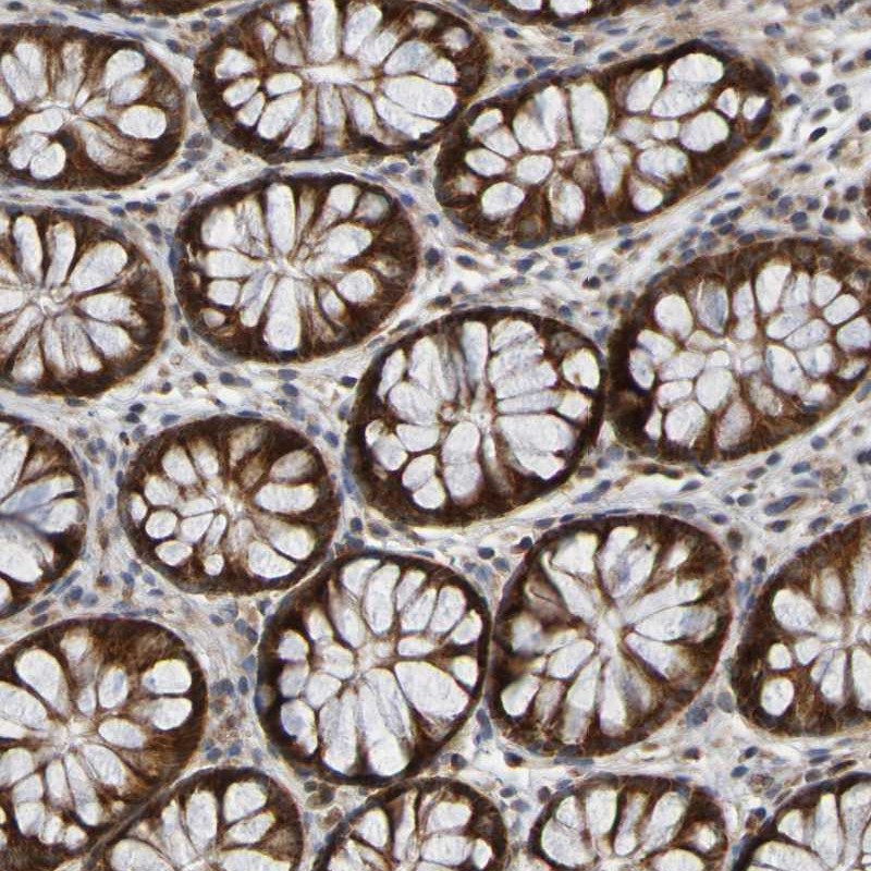 Anti-CCDC51 Antibody