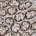 Anti-CCDC51 Antibody