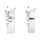 Western blot analysis using Anti-CCDC51 antibody HPA011408 (A) shows similar pattern to independent antibody HPA010980 (B).
