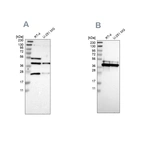Western blot analysis using Anti-CCDC51 antibody HPA011408 (A) shows similar pattern to independent antibody HPA010980 (B).