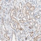 Anti-PEX2 Antibody