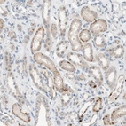 Anti-PEX2 Antibody