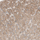 Immunohistochemical staining of human liver shows moderate granular cytoplasmic positivity in hepatocytes.