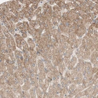 Immunohistochemical staining of human liver shows moderate granular cytoplasmic positivity in hepatocytes.
