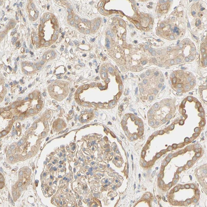 Anti-KCNE4 Antibody