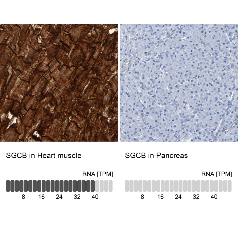 Anti-SGCB Antibody