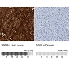 Anti-SGCB Antibody
