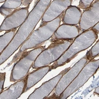 Immunohistochemical staining of human skeletal muscle shows moderate membranous positivity in myocytes.