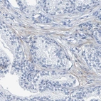 Immunohistochemical staining of human prostate shows very weak membranous positivity in smooth muscle cells.