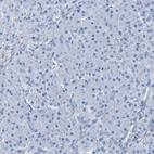 Immunohistochemical staining of human pancreas shows no positivity in exocrine glandular cells as expected.