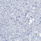 Anti-ERVMER34-1 Antibody