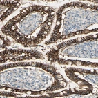 Anti-RNF149 Antibody