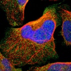 Immunofluorescent staining of human cell line U-2 OS shows localization to plasma membrane & vesicles.