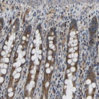 Immunohistochemical staining of human rectum shows moderate granular cytoplasmic positivity in glandular cells.