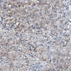 Anti-KIAA1024 Antibody