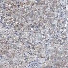 Anti-KIAA1024 Antibody
