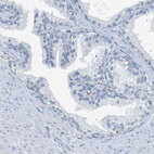 Immunohistochemical staining of human prostate shows no positivity in glandular cells as expected.