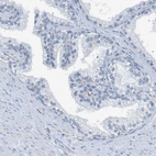 Immunohistochemical staining of human prostate shows no positivity in glandular cells as expected.