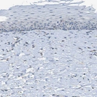 Immunohistochemical staining of human cervix shows no positivity in squamous epithelial cells as expected.