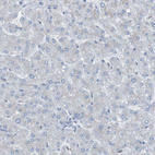 Immunohistochemical staining of human liver shows no positivity in hepatocytes as expected.