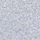 Immunohistochemical staining of human liver shows no positivity in hepatocytes as expected.
