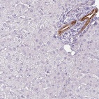 Anti-SIRPB2 Antibody