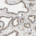 Immunohistochemical staining of human prostate shows strong positivity in Golgi apparatus in glandular cells.