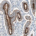 Immunohistochemical staining of human endometrium shows strong positivity in Golgi apparatus in glandular cells.
