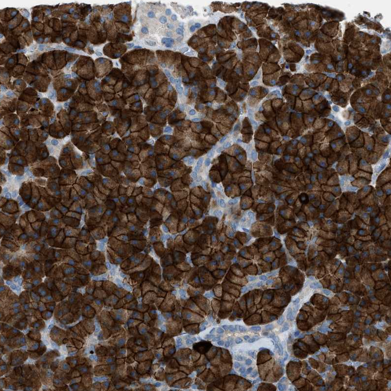 Anti-HEG1 Antibody